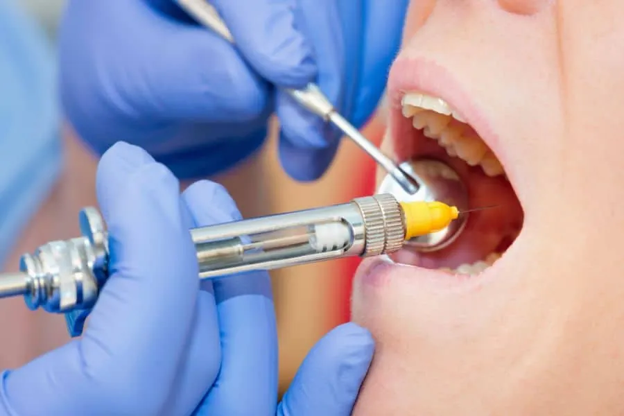 root canal treatment