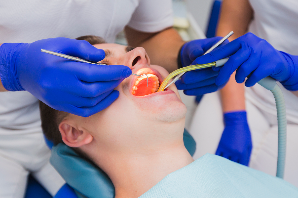 Root Canal Treatments