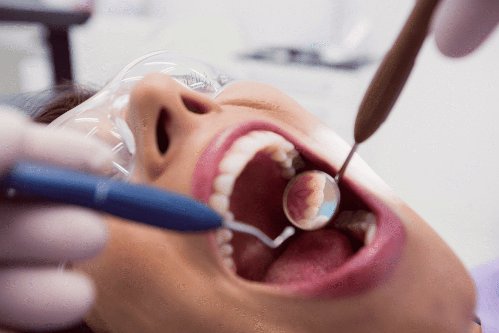 Molar Root Canal Treatment 1 1
