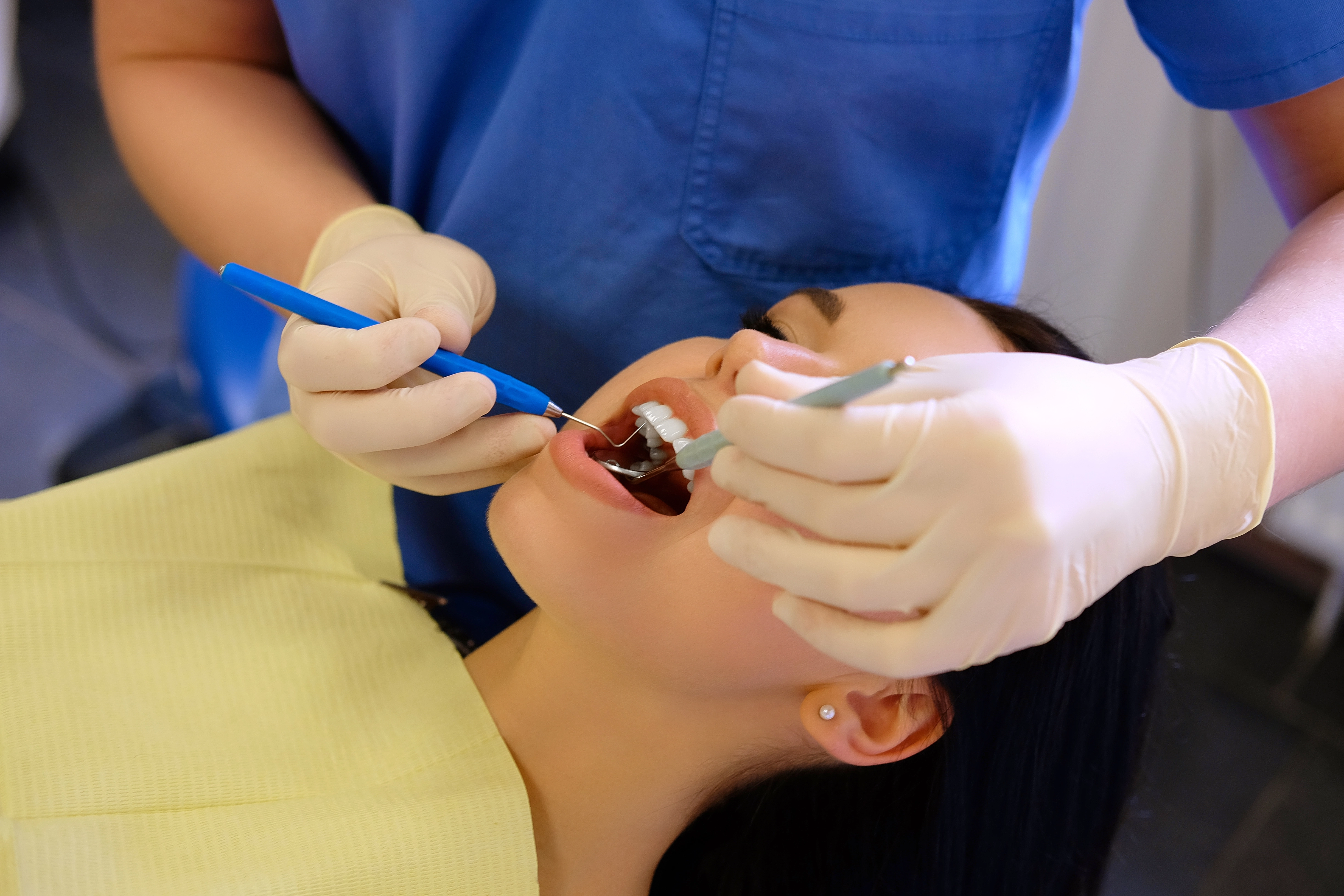 How Much Does Wisdom Tooth Removal Cost in Sydney?