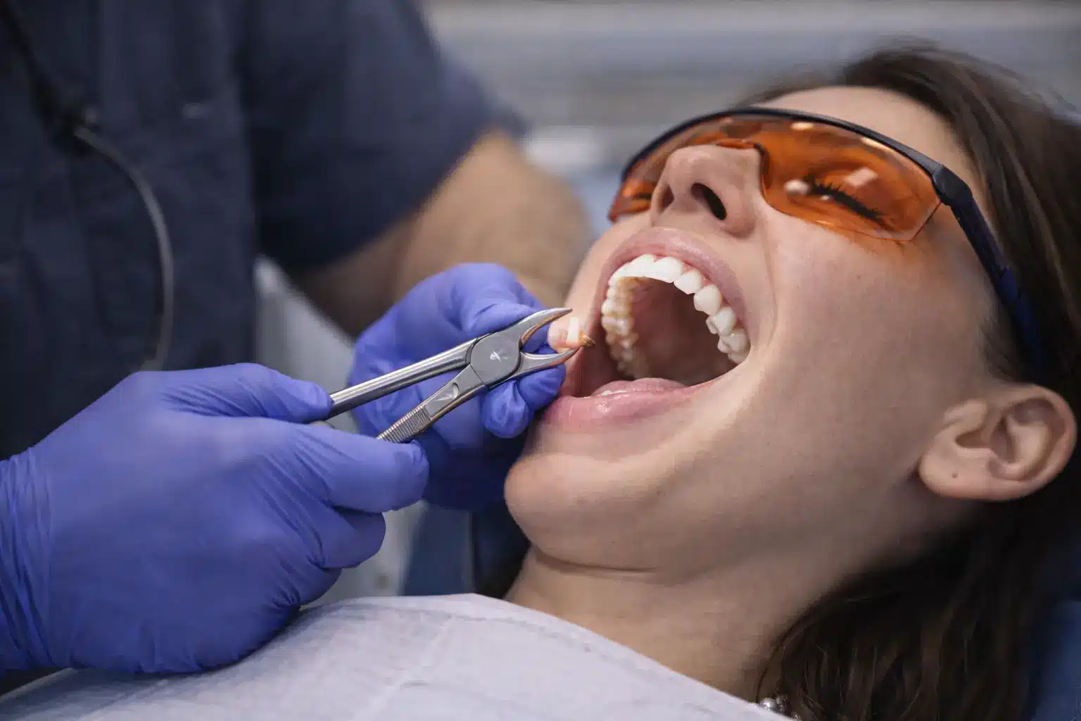 Simple Tooth Extraction