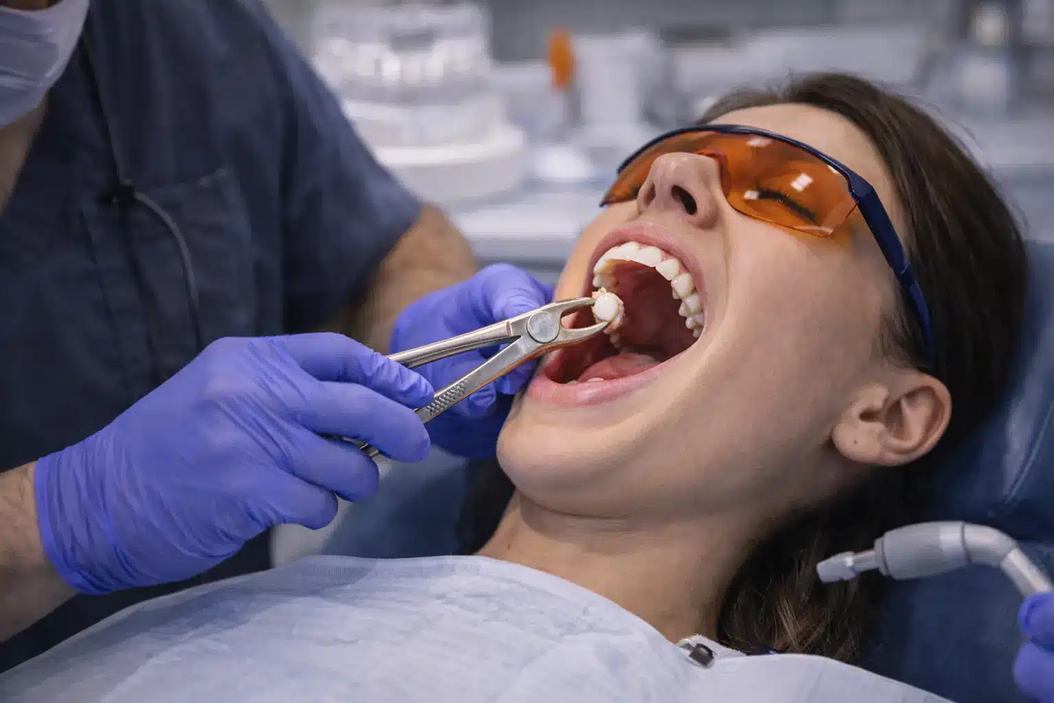 Pre-Orthodontic Extractions