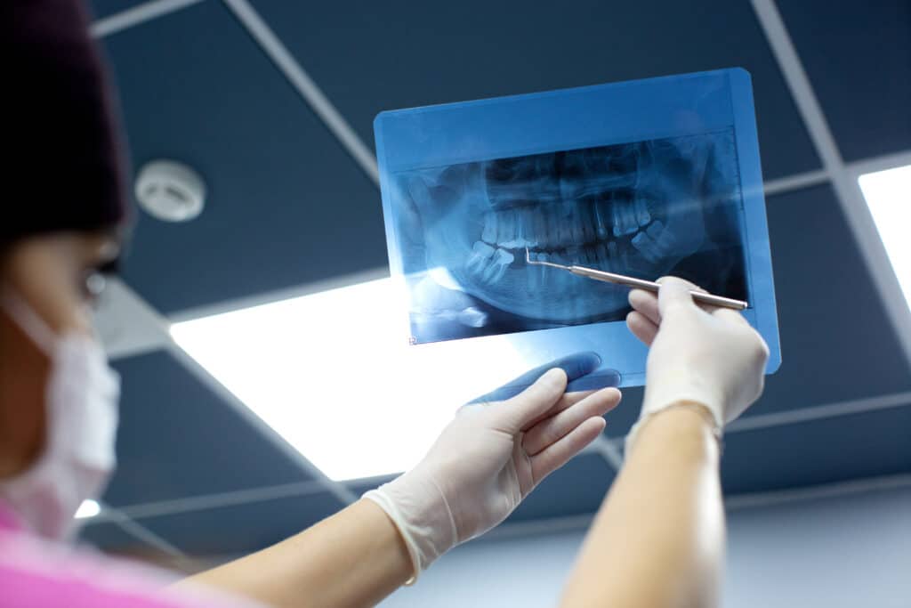 X-Rays