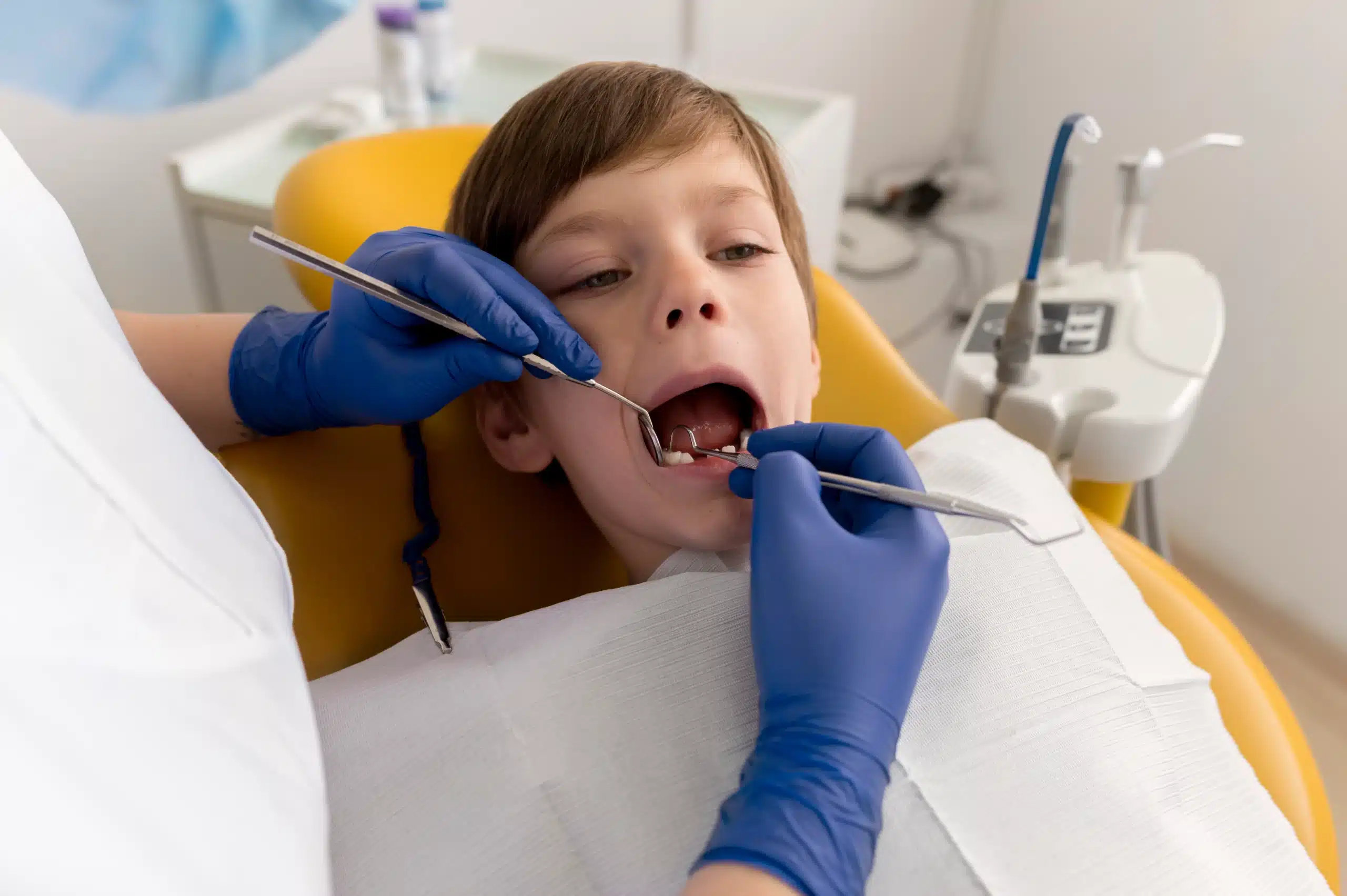 Fissure Sealants for Children