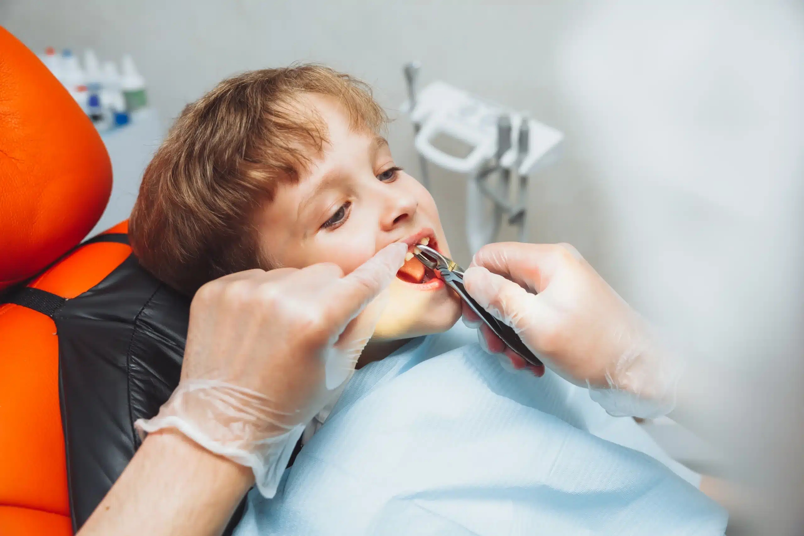 Children's Tooth Extractions