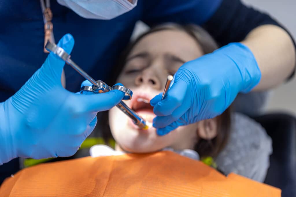 Root Canal
