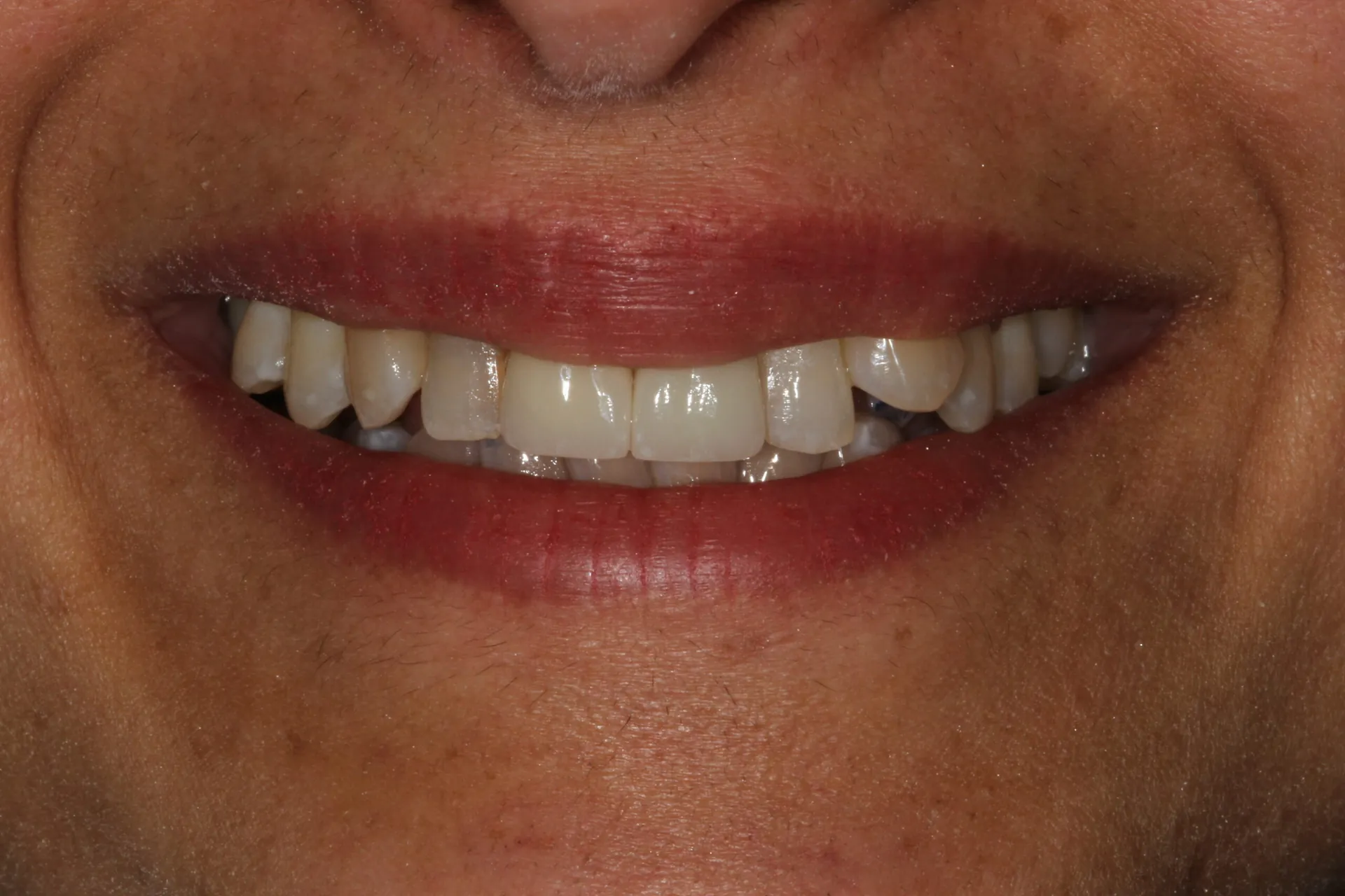 After