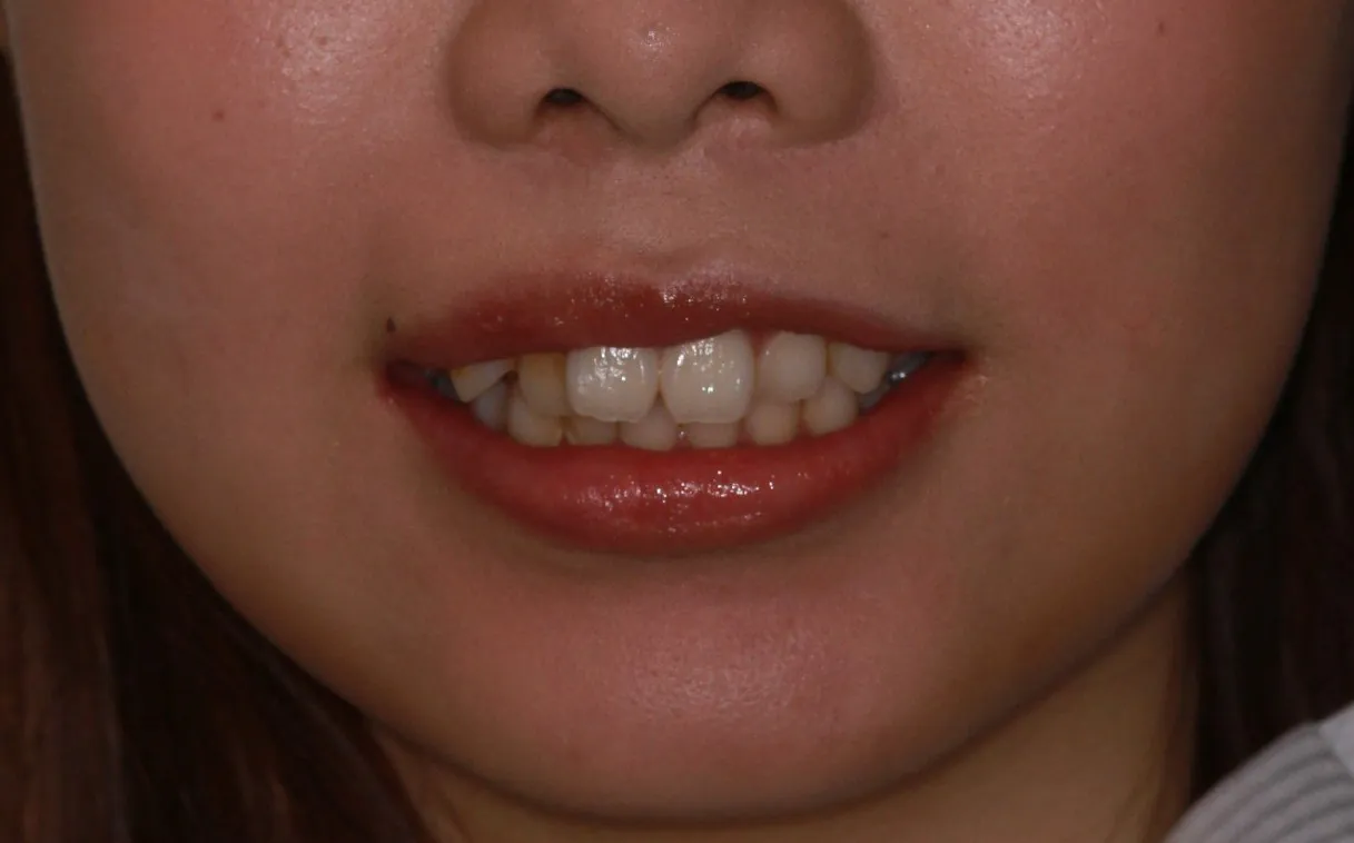 Before treatment