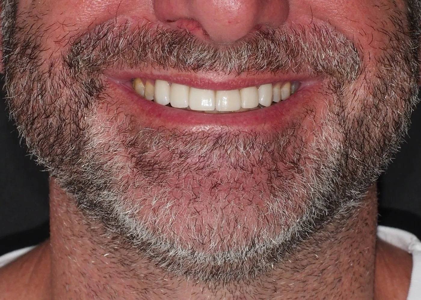 After treatment