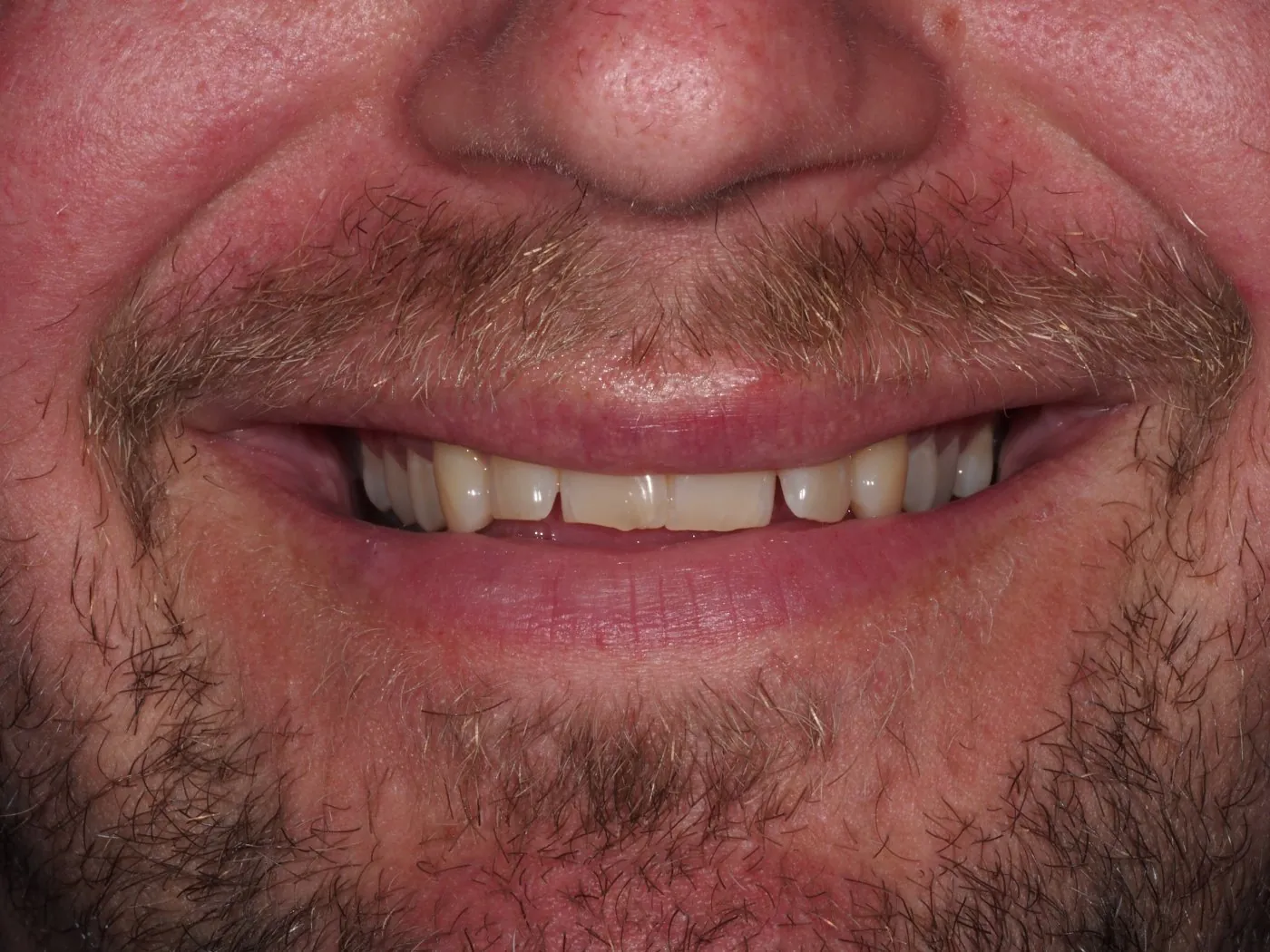 Before treatment