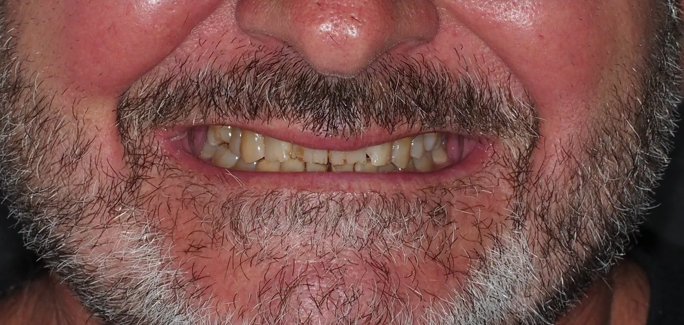 Before treatment