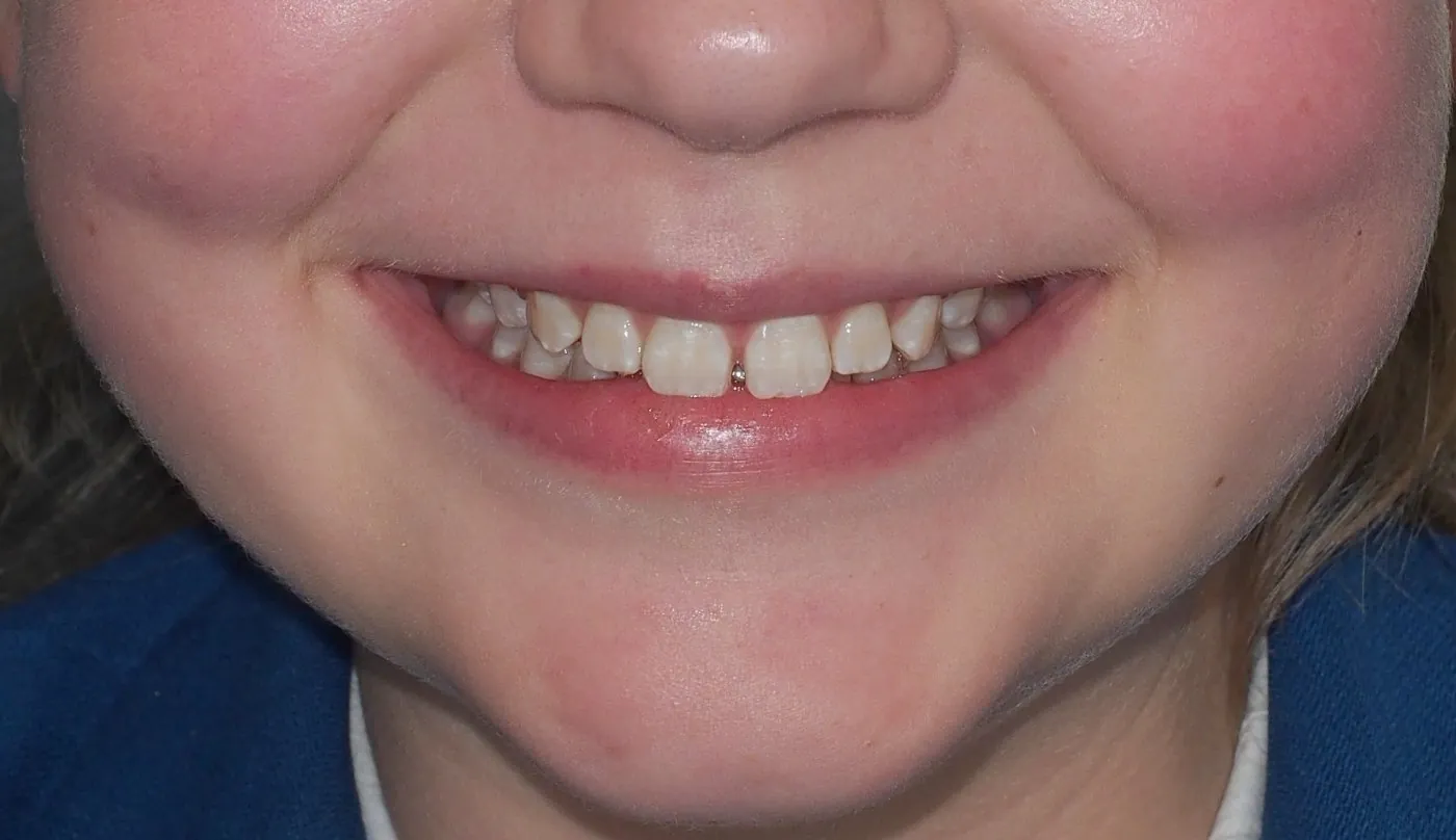 Before treatment